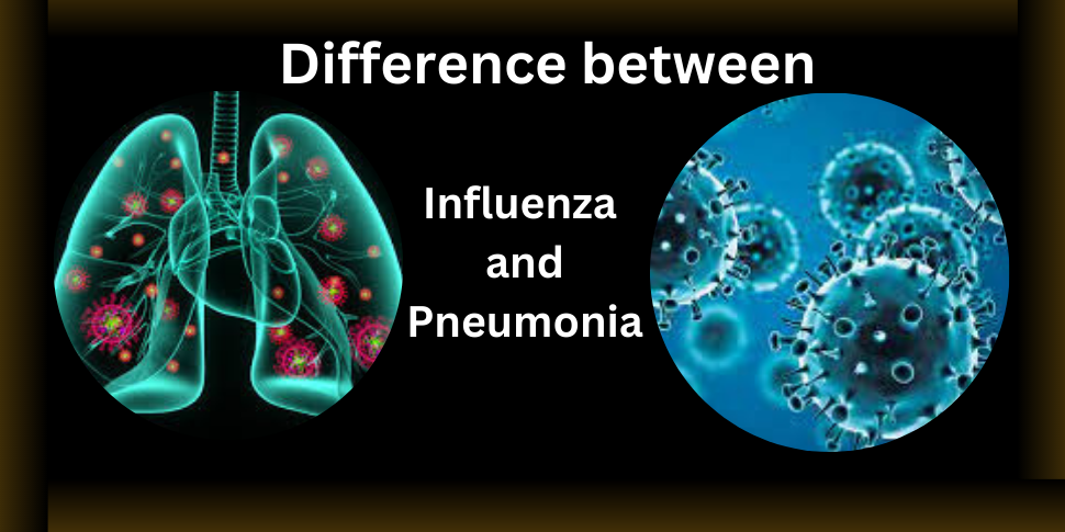 influenza and pneumonia